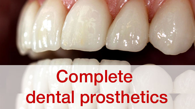 Complete dental prosthetics