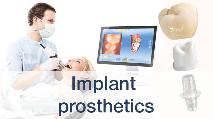 Implant prosthetics