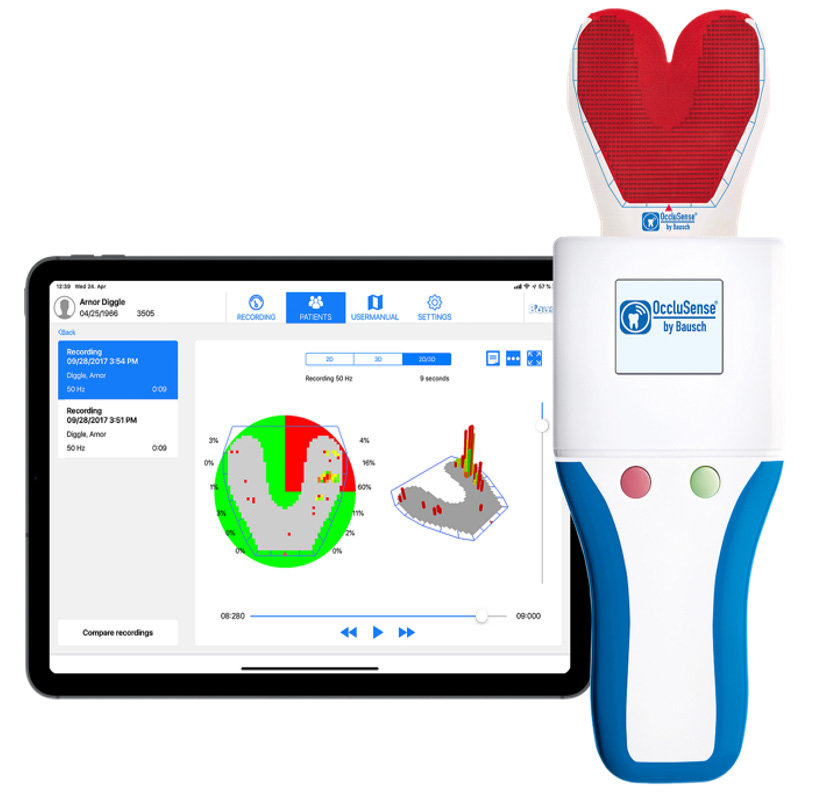 Occlusion monitoring after prosthetic dentures using the OccluSense digital sensor.